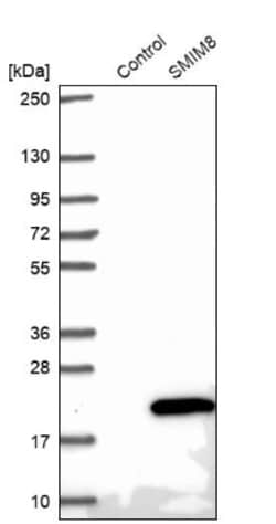 SMIM8 Antibody, Novus Biologicals 0.1mL; Unlabeled:Antibodies, Polyclonal